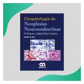 Sudha R. Kini - Neoplasias...