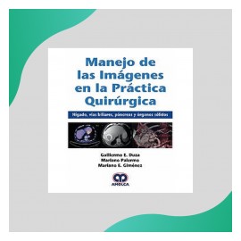 Duza - Manejo de las...