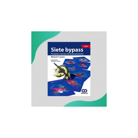 Lawton - Siete Bypass - Amolca