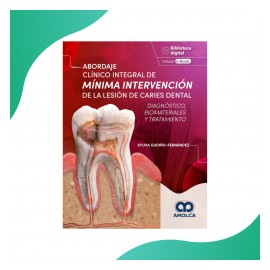 Gudiño - Lesió en Caries