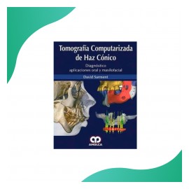 Sarment - Tomografía...