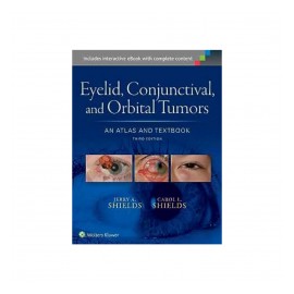 Shields - Eyelid,...