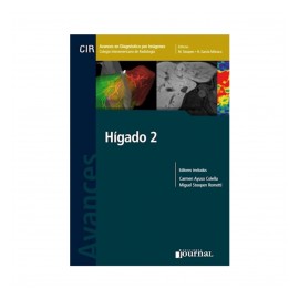 Ayuso - Hígado - Journal