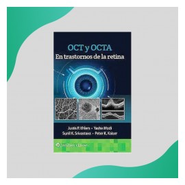 Ehlrs - OCT y OCTA...