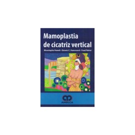 Hamdi - Mamoplastia de...