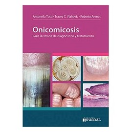 Tosti - Onicomicosis - Journal