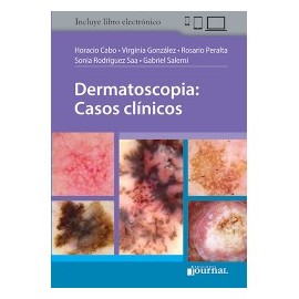 Cabo - Dermatoscopia: Casos...